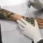 Removendo uma tatuagem em menos de um minuto